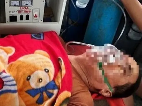 Sử dụng máy phát điện khi bão số 5 tràn qua, hai người dân nguy kịch vì ngạt khí