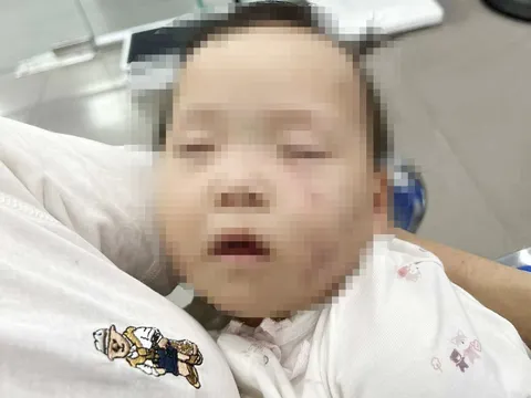 Tạm giữ một giáo viên mầm non có dấu hiệu bạo hành trẻ: Kết quả điều tra ban đầu ra sao?
