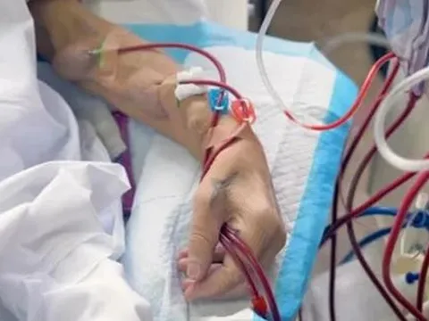 Cô gái 22 tuổi suy thận, ngừng tim sau 4 năm lạm dụng thuốc giảm cân: Bác sĩ tiết lộ lý do nguy hiểm