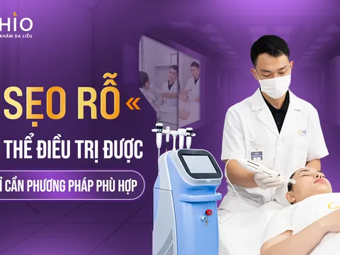 Bác sĩ da liễu Nguyễn Thế Anh: “Điều trị sẹo rỗ phải có phác đồ phù hợp và cần dựa trên cơ sở khoa học”