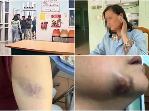 Nữ y sĩ bị 3 người đàn ông đánh hội đồng: Hỏi vì sao chửi bác sĩ là chó mèo thì bị đánh hội đồng