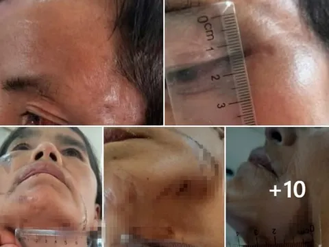 Vụ bắt giữ người vì nghi bị bỏ bùa ở Điện Biên: Chính quyền nói gì?