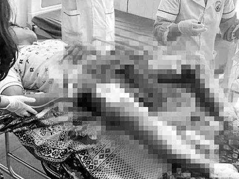 Hiện trường xót xa và ám ảnh khi người đàn ông bị bỏng nặng vùng kín nằm bất tỉnh ven đường