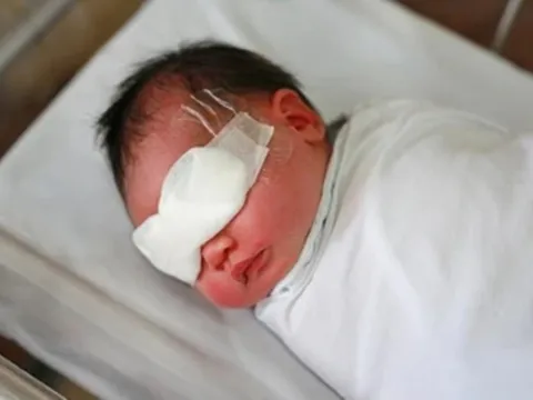 Một bé trai 2 tuổi mất thị lực mắt trái vì hành động này của người thân