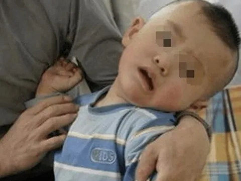 Mẹ sụp đổ khi biết thói quen tưởng tốt mỗi ngày của mình khiến con 8 tháng bị thiểu năng trí tuệ