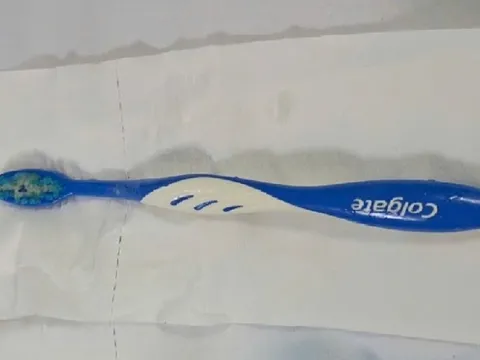 Hy hữu: Người phụ nữ nuốt bàn chải đánh răng dài 17cm vào thực quản