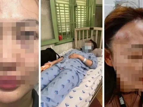 Vụ thanh niên "bắt cá hai tay", đánh bạn gái bất tỉnh ở quán cà phê: Tình tiết mới nhất