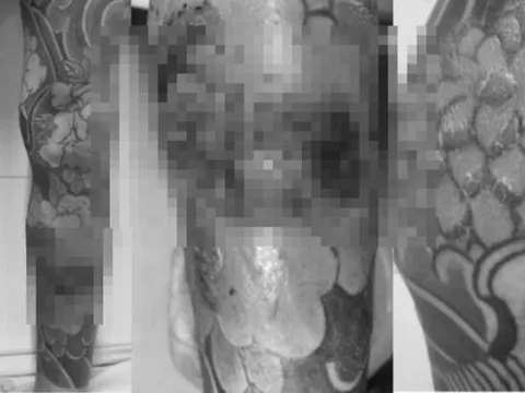 Thanh niên gặp biến chứng vì xăm kín 2 chân