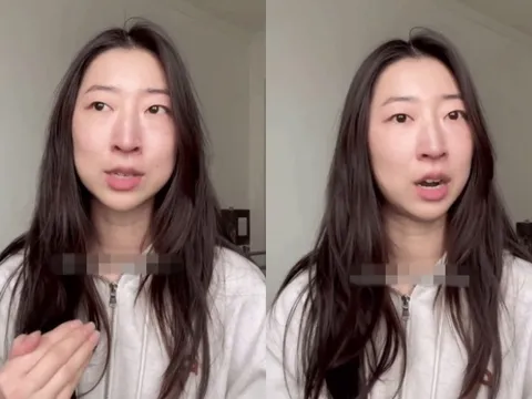 Nghệ nhân gốm sứ hỏng một mắt vì tiêm collagen, phản ứng của bác sĩ gây "sốc"