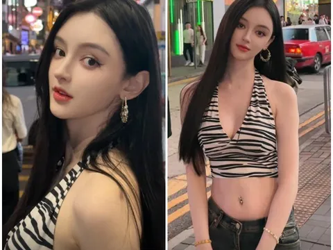 Bé gái câm điếc thành hoa khôi trường đại học, bị nghi ngờ PTTM vì mặt đẹp hoàn hảo không chỗ chê