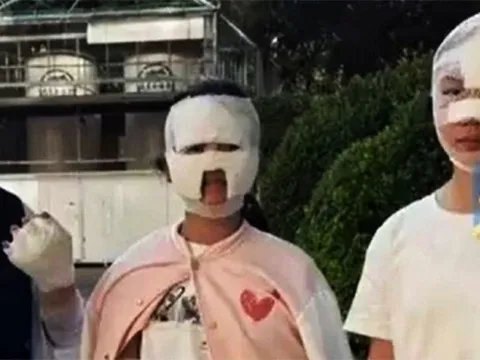 Bữa nướng thịt biến thành thảm kịch sau tiếng nổ từ bếp gas, 7 người bị thương