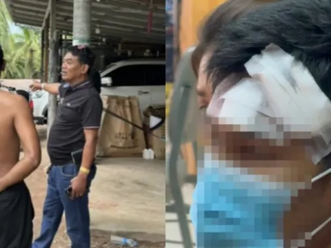 Một nam shipper bị chồng khách hàng nữ tấn công phải khâu 24 mũi khi đến nhà lấy tiền hàng