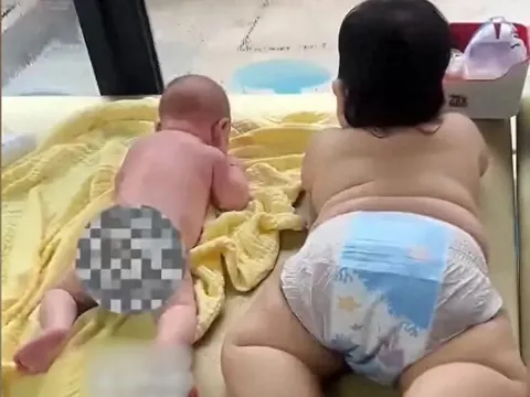 Bé trai 5 tháng tuổi đã to gấp đôi người anh 7 tháng, kết luận của bác sĩ khiến mẹ bỉm hối hận