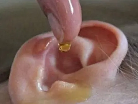 Con gái mẫu giáo bị sinh vật lạ chui vào tai, chỉ với một hành động người mẹ được bác sĩ khen “Rất thông minh”