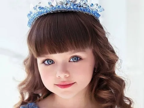 Bé gái nổi tiếng thế giới bị người lạ làm phiền vì quá xinh đẹp, 10 năm sau dậy thì xong nhan sắc thay đổi lớn