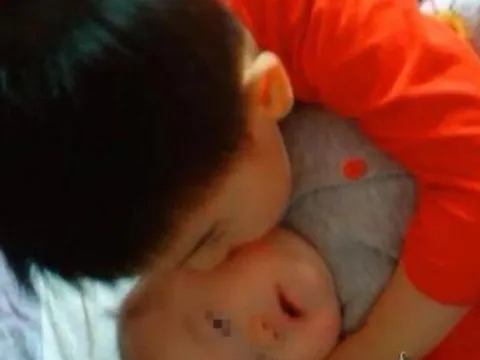 Người mẹ phát hiện con 1 tuổi cứ được anh trai bế là khóc thét, lúc kiểm tra cơ thể đứa trẻ, mẹ mới tá hoả