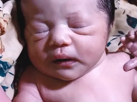 Con sơ sinh chào đời 7 ngày vẫn chưa mở mắt, tưởng con gặp vấn đề mẹ liền đưa đến bệnh viện, kết quả không ngờ