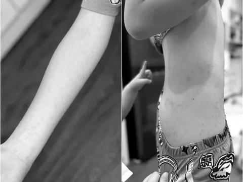 Mẹ Hà Nội bức xúc vì chi gần 20 triệu đồng cho con đi trại hè nhưng con bị bắt nạt, nhịn 8 ngày không đi vệ sinh