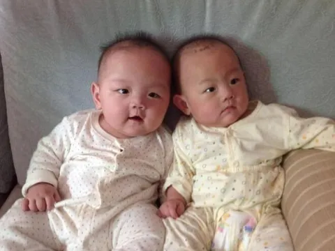 Sinh đôi nhưng diện mạo khác nhau, một bé da đen một bé da trắng, chồng lén vợ xét nghiệm ADN, kết quả khó tin