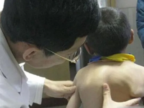 Mẹ phát hiện lưng con ngày càng biến dạng, biết nguyên nhân do thói quen của bà nội, người mẹ hối hận