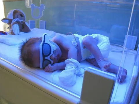 Bác sĩ đề nghị điều trị vàng da cho cháu sơ sinh nhưng bà nội kiên quyết từ chối, 1 tháng sau cả gia đình suy sụp