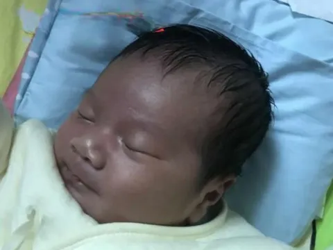 Con sơ sinh chào đời làn da lúc đen xì lúc tím tái, bố mẹ sợ hãi không dám bế và cái kết sau 1 tháng