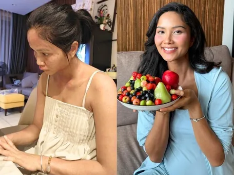 Chi nửa tỷ/tháng để ở cữ, H'Hen Niê nay "biến dạng" ngoại hình vì bệnh lạ sau sinh, chỉ 1/10 người gặp phải