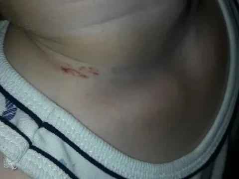 Đón con đi học về thì phát hiện trên cổ bé có vết bầm, kiểm tra camera mẹ Nga bủn rủn với cảnh tượng giữa lớp