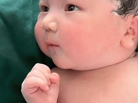 Vừa chào đời bé sơ sinh đã gây náo loạn phòng đẻ vì quá đẹp, bác sĩ phải thốt lên: “Trời ơi, đáng yêu quá”