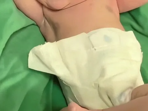 Bé sơ sinh khiến y tá đỡ đẻ “cười xỉu” trong phòng mổ, vừa chào đời thần thái đã chuẩn soái ca tương lai