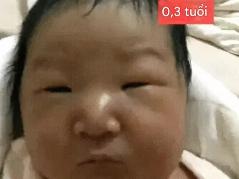 Bé sơ sinh chào đời bị gọi là "vịt con xấu xí", vài năm sau lột xác thành búp bê Hoa khôi bao chàng mê