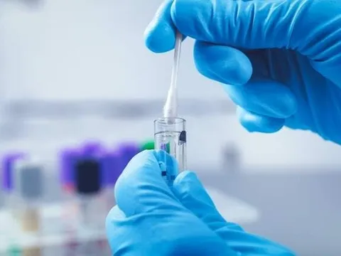 Đi xét nghiệm ADN phát hiện con không chung huyết thống, chồng đòi ly hôn, vợ làm một việc gây sốc