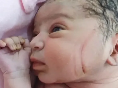 Vừa rời phòng đẻ phát hiện nhiều vết thương trên mặt con sơ sinh, gia đình nghi ngờ bác sĩ tắc trách, đòi kiện