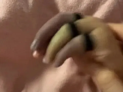 Con ngồi chơi ở phòng khách bỗng khóc rống lên, mẹ phát hoảng thấy tay con 3 màu, bác sĩ cảnh báo