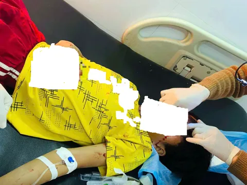 Nam sinh lớp 8 dập nát bàn tay vì điện thoại phát nổ khi đang sạc