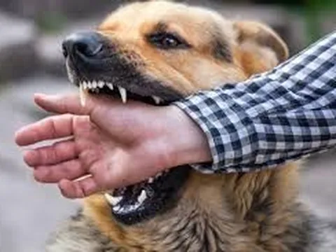 Diễn biến sức khỏe của 3 người ở Mũi Né bị chó dại tấn công