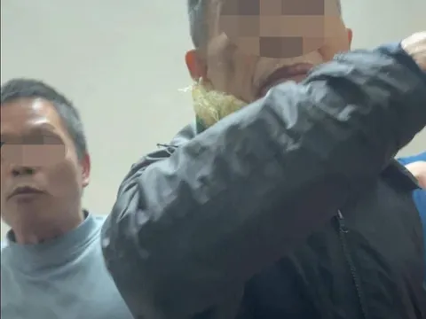 Sinh viên run rẩy cảnh báo bị chủ nhà trọ hành hung, tiết lộ đau xót những điều không có camera ghi lại