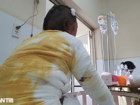 Những tâm sự đau nhói lòng của người mẹ bị chính con trai ruột đổ xăng thiêu như đuốc sống: "Có làm gì, nó cũng là con mình"