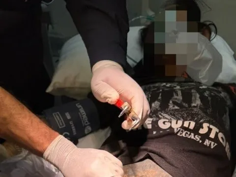 Bi hài: Đeo nhẫn vào "của quý" để cải thiện kích cỡ, người đàn ông mắc kẹt trong đau đớn, lên bàn mổ gấp