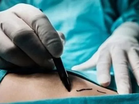 Mức phạt với người có hành vi chiếm đoạt bộ phận cơ thể người