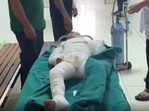 Thương tâm: Người mẹ hoảng hốt nhìn thấy con như ngọn đuốc sống sau tiếng khóc thất thanh