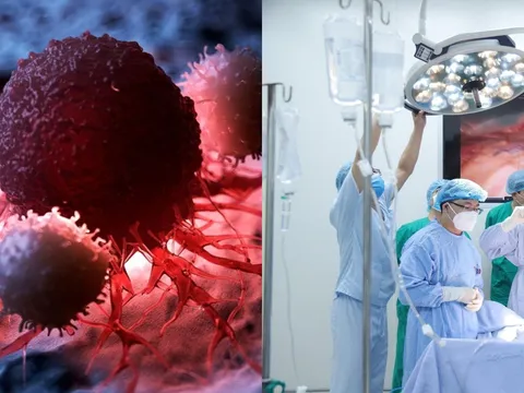 6 thói quen thường gặp khiến người trẻ dễ mắc ung thư cần biết để tránh ngay