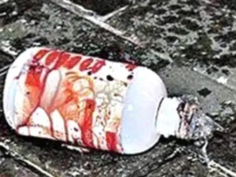 Nữ sinh viên bị bạn trai tạt axit vì từ chối lời cầu hôn ngày 14/2