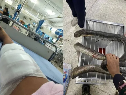 Bị rắn hổ mang dài 3 mét cắn, người phụ nữ tay không hạ gục con rắn mang xác đến viện cấp cứu