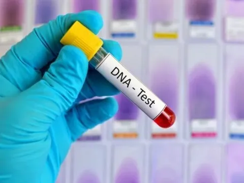 Lén xét nghiệm ADN con nuôi của em rể, chị dâu xấu hổ bỏ chạy khi sự thật bị vạch trần