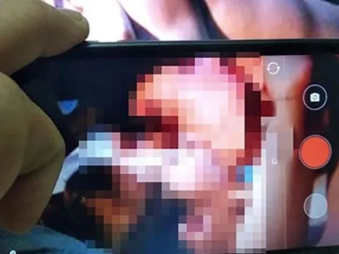 Thiếu nữ bị tra tấn trong 6 tháng như thời trung cổ vì từ chối quay clip nhạy cảm