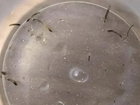 Bé gái 8 tuổi 'nôn ra giun sống' suốt cả tháng: Bác sĩ tiết lộ thủ phạm nhiều nhà đều có