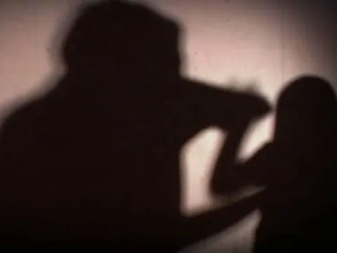 Bé gái 5 tuổi bị bố ruột bạo hành bằng thuốc lá vì không chịu đi ngủ