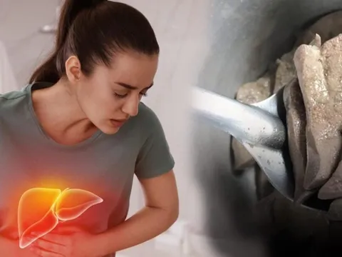 1 bộ phận đại bổ của con lợn nhiều người thích mê: Nếu ăn sai cách dễ đột quỵ, âm thầm rút ngắn tuổi thọ