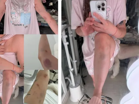 Ám ảnh khoảnh khắc: Hot girl nổi tiếng MXH bị 2 gã đàn ông sàm sỡ rồi hành hung, người đi đường dửng dưng mặc kệ
